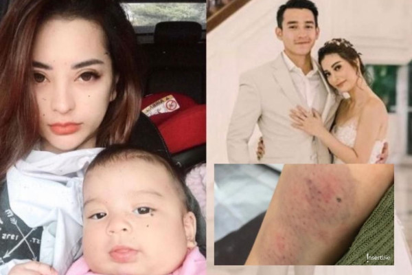 Sia ambil dua orang anak angkat lelaki sejak Mei tahun 