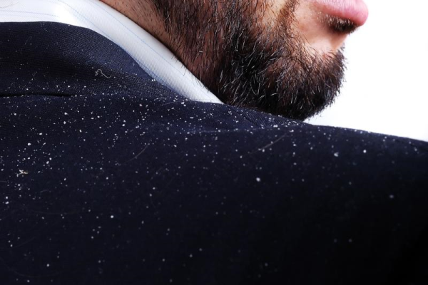 "Berhenti cuba ubah anak autisme" - Khairy Jamaluddin dan ...