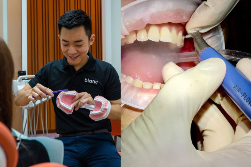 Harga scaling gigi swasta 2021